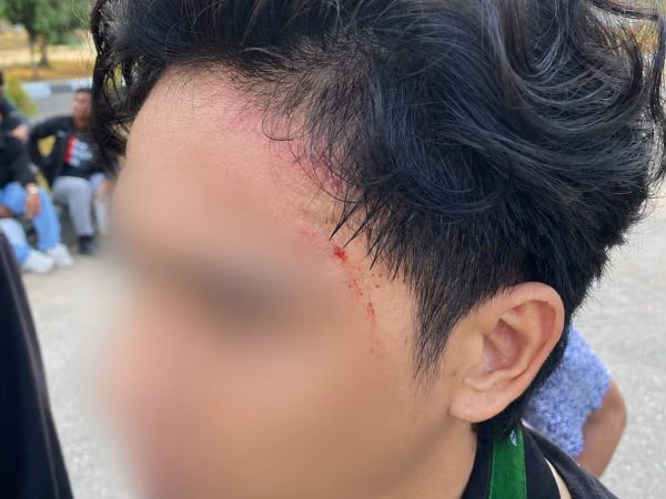 Aksi HMI Kendari di Kantor Gubernur Sulawesi Tenggara Berujung Kericuhan, Kader Mengaku Dipukul Satpol PP